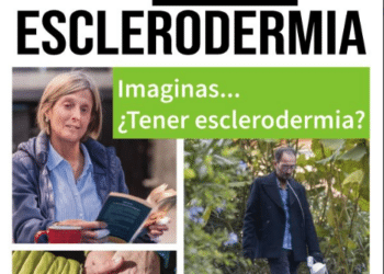 El Ayuntamiento de Las Rozas se ilumina de verde para visibilizar la esclerodermia