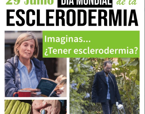 El Ayuntamiento de Las Rozas se ilumina de verde para visibilizar la esclerodermia